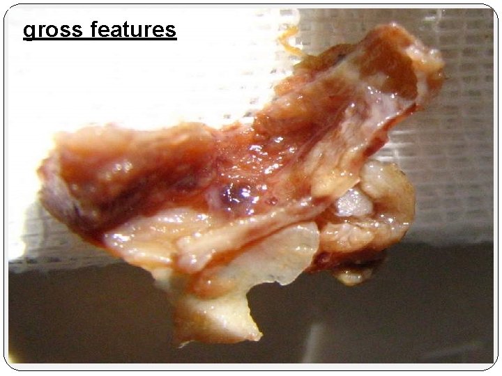 gross features 