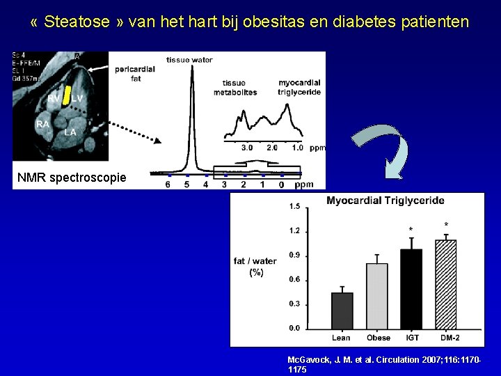  « Steatose » van het hart bij obesitas en diabetes patienten NMR spectroscopie