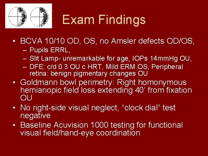 Exam Findings • BCVA 10/10 OD, OS, no Amsler defects OD/OS, – Pupils ERRL,