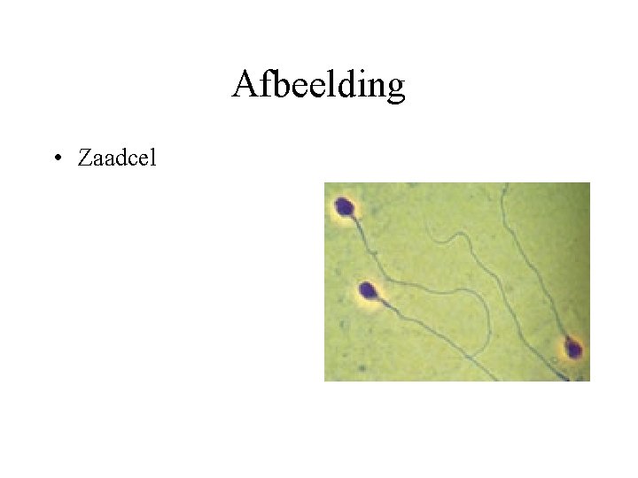 Afbeelding • Zaadcel 