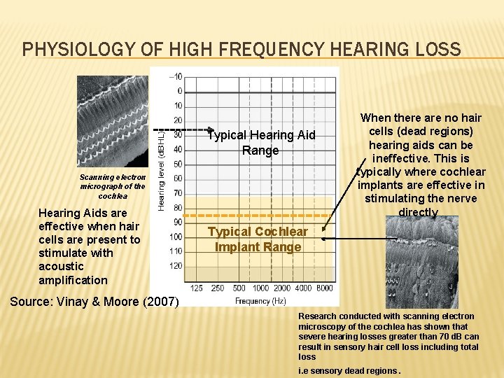 PHYSIOLOGY OF HIGH FREQUENCY HEARING LOSS Typical Hearing Aid Range Scanning electron micrograph of