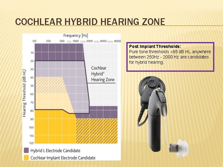 COCHLEAR HYBRID HEARING ZONE Post Implant Thresholds: Pure tone thresholds <85 d. B HL