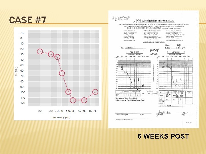 CASE #7 6 WEEKS POST 