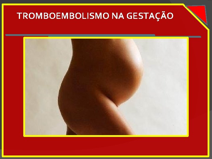 TROMBOEMBOLISMO NA GESTAÇÃO 
