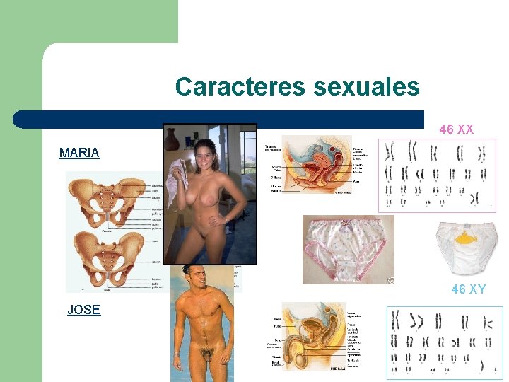 Caracteres sexuales 46 XX MARIA 46 XY JOSE 