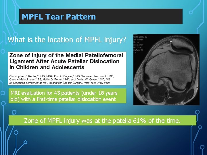 MPFL Tear Pattern What is the location of MPFL injury? MRI evaluation for 43