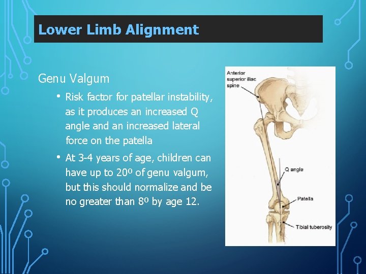 Lower Limb Alignment Genu Valgum • Risk factor for patellar instability, as it produces