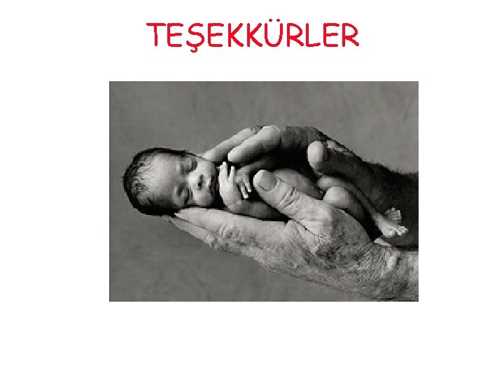 TEŞEKKÜRLER 