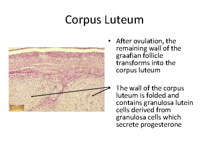 Corpus Luteum • After ovulation, the remaining wall of the graafian follicle transforms into