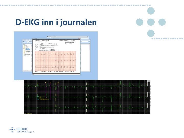 D-EKG inn i journalen 