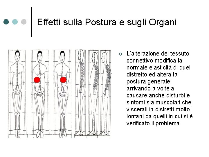 Effetti sulla Postura e sugli Organi ¢ L’alterazione del tessuto connettivo modifica la normale