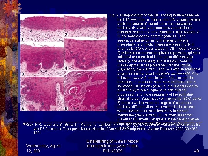 Fig. 2. Histopathology of the CIN scoring system based on the K 14 -HPV