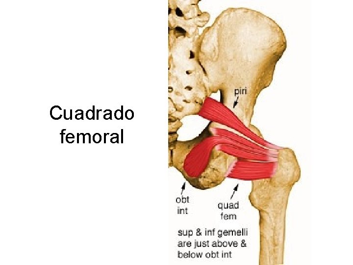 Cuadrado femoral 