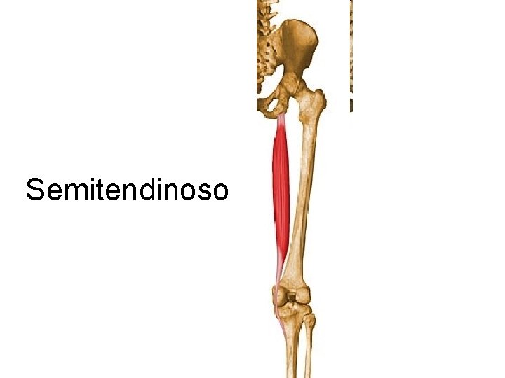 Semitendinoso 