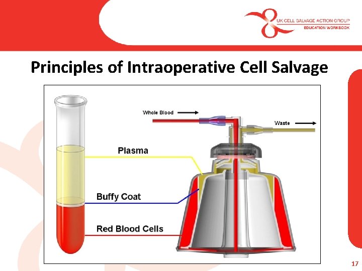 Principles of Intraoperative Cell Salvage 17 