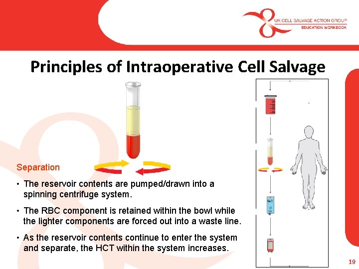 Principles of Intraoperative Cell Salvage Separation • The reservoir contents are pumped/drawn into a