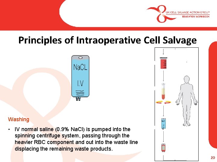 Principles of Intraoperative Cell Salvage Washing • IV normal saline (0. 9% Na. Cl)
