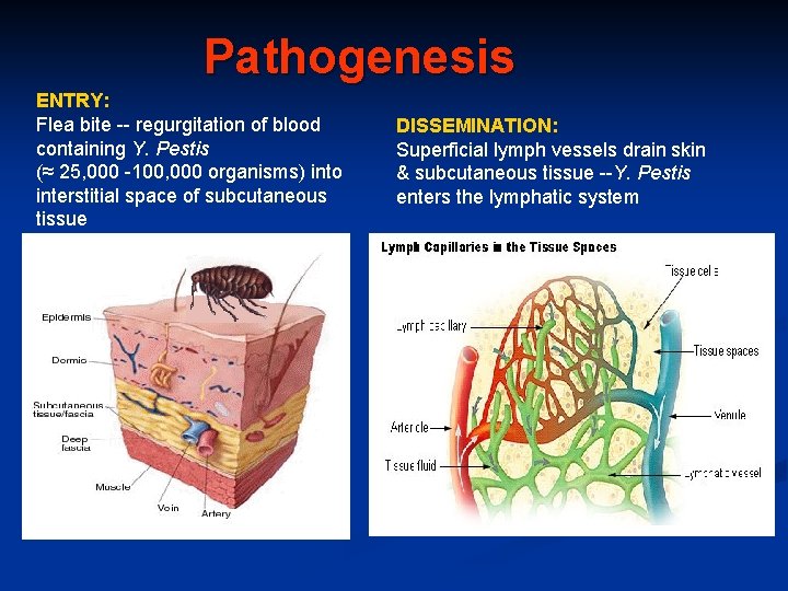 Pathogenesis ENTRY: Flea bite -- regurgitation of blood containing Y. Pestis (≈ 25, 000