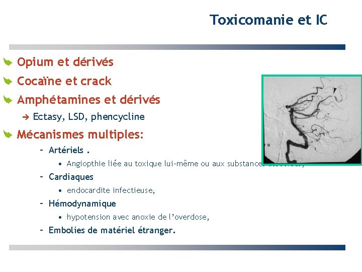 Toxicomanie et IC Opium et dérivés Cocaïne et crack Amphétamines et dérivés Ectasy, LSD,