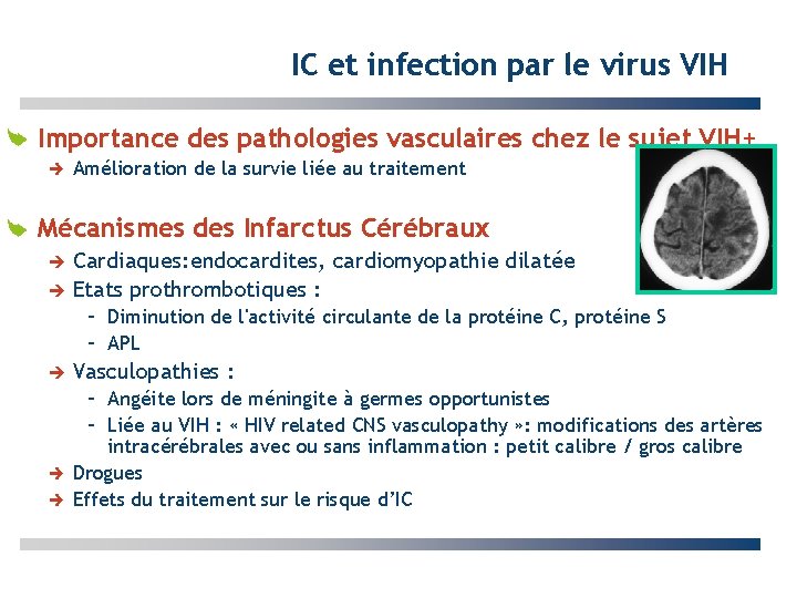 IC et infection par le virus VIH Importance des pathologies vasculaires chez le sujet