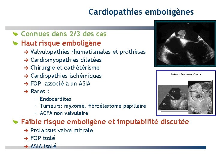 Cardiopathies emboligènes Connues dans 2/3 des cas Haut risque emboligène Valvulopathies rhumatismales et prothèses