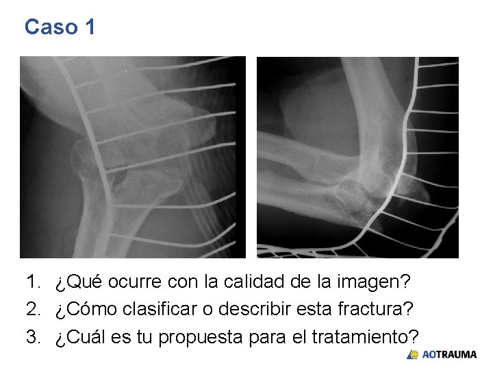 Caso 1 1. ¿Qué ocurre con la calidad de la imagen? 2. ¿Cómo clasificar