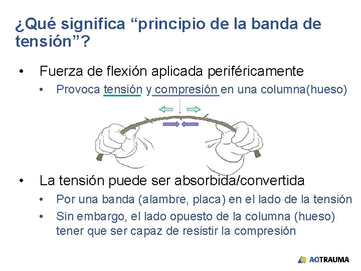 ¿Qué significa “principio de la banda de tensión”? • Fuerza de flexión aplicada periféricamente