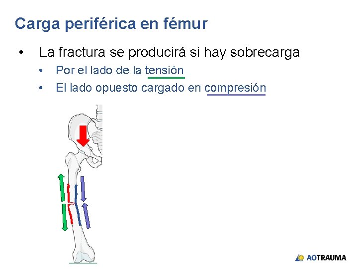 Carga periférica en fémur • La fractura se producirá si hay sobrecarga • •