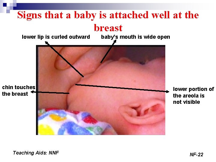 Signs that a baby is attached well at the breast lower lip is curled