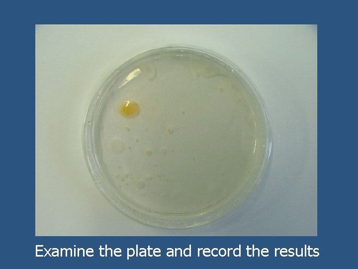 Examine the plate and record the results 