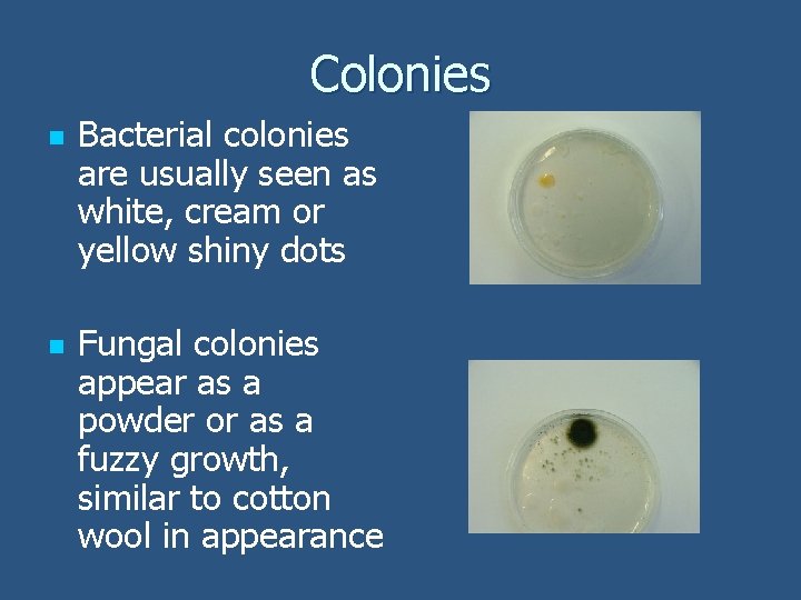 Colonies n n Bacterial colonies are usually seen as white, cream or yellow shiny