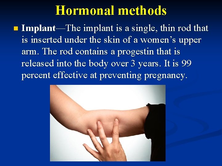 Hormonal methods n Implant—The implant is a single, thin rod that is inserted under