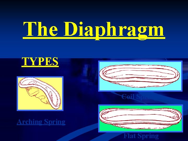 The Diaphragm TYPES Coil Spring Arching Spring Flat Spring 