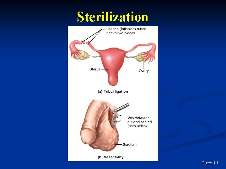 Sterilization Figure 7. 7 