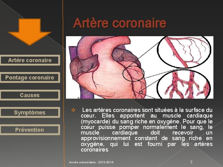 Artère coronaire Pontage coronaire Causes Symptômes Prévention v Les artères coronaires sont situées à