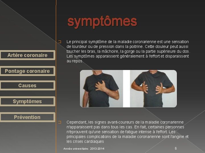 symptômes � Le principal symptôme de la maladie coronarienne est une sensation de lourdeur