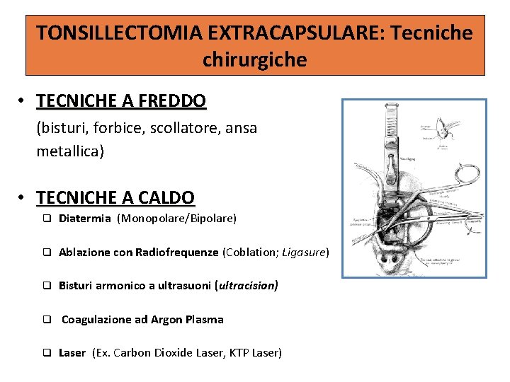 TONSILLECTOMIA EXTRACAPSULARE: Tecniche chirurgiche • TECNICHE A FREDDO (bisturi, forbice, scollatore, ansa metallica) •