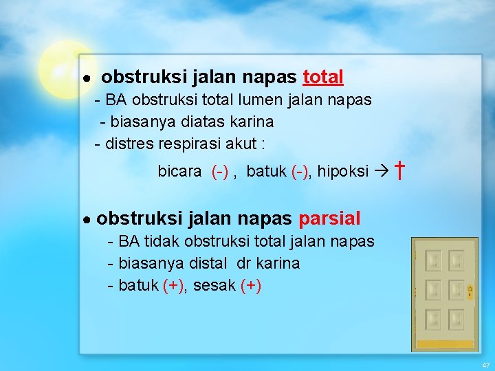  ● obstruksi jalan napas total - BA obstruksi total lumen jalan napas -