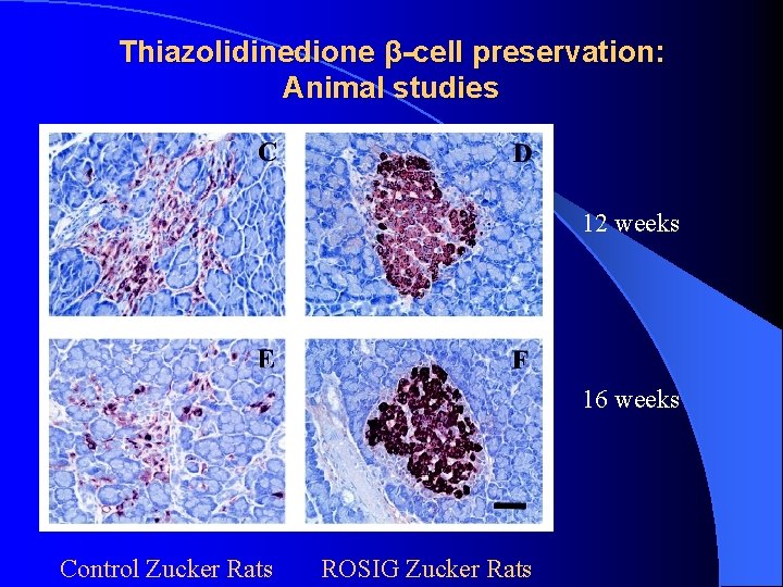 Thiazolidinedione β-cell preservation: Animal studies 12 weeks 16 weeks Control Zucker Rats ROSIG Zucker