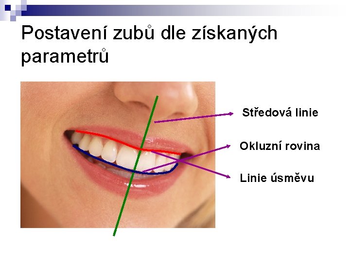 Postavení zubů dle získaných parametrů Středová linie Okluzní rovina Linie úsměvu 