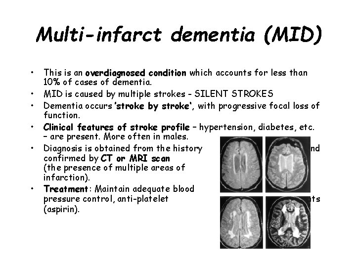 Multi-infarct dementia (MID) • • • This is an overdiagnosed condition which accounts for