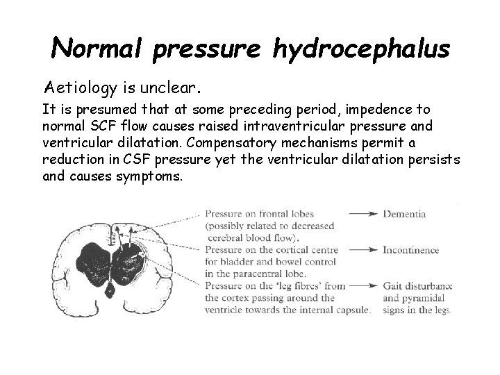 Normal pressure hydrocephalus Aetiology is unclear. It is presumed that at some preceding period,