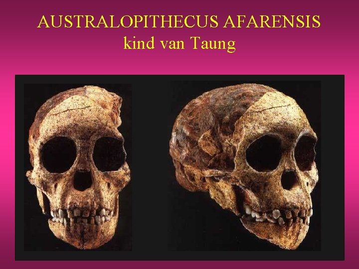 AUSTRALOPITHECUS AFARENSIS kind van Taung 