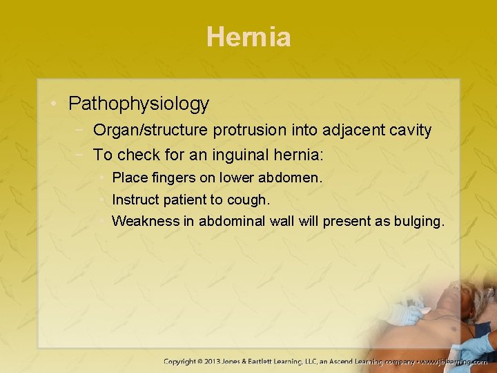 Hernia • Pathophysiology − Organ/structure protrusion into adjacent cavity − To check for an