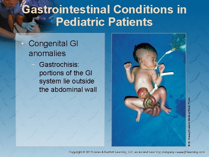 Gastrointestinal Conditions in Pediatric Patients • Congenital GI anomalies © M. Ansary/Custom Medical Stock