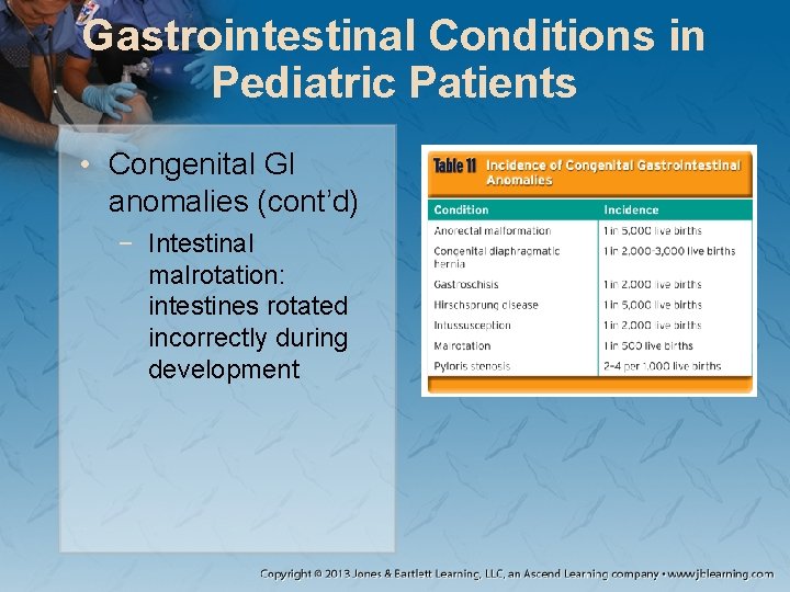 Gastrointestinal Conditions in Pediatric Patients • Congenital GI anomalies (cont’d) − Intestinal malrotation: intestines