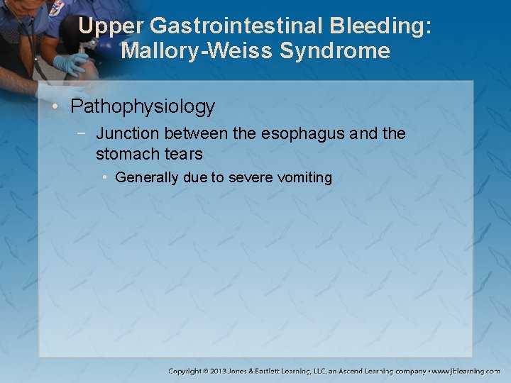 Upper Gastrointestinal Bleeding: Mallory-Weiss Syndrome • Pathophysiology − Junction between the esophagus and the