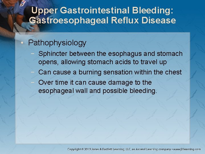 Upper Gastrointestinal Bleeding: Gastroesophageal Reflux Disease • Pathophysiology − Sphincter between the esophagus and