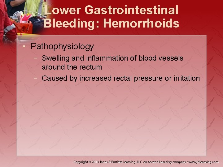Lower Gastrointestinal Bleeding: Hemorrhoids • Pathophysiology − Swelling and inflammation of blood vessels around