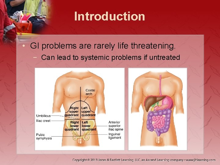 Introduction • GI problems are rarely life threatening. − Can lead to systemic problems